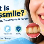 Brasssmile